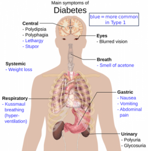 Symptomer på sukkersyge